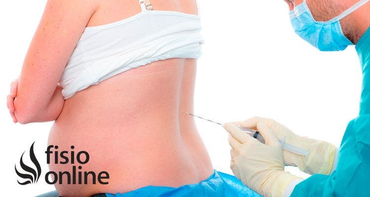 Cuanto tiempo dura la anestesia epidural en el cuerpo